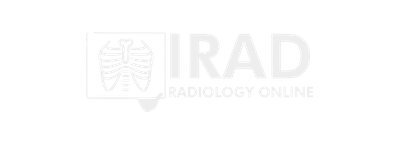 iRad logo
